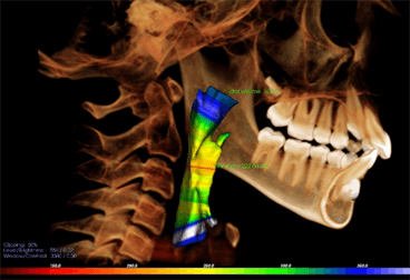 3D Orthodontics 3D Orthodontics