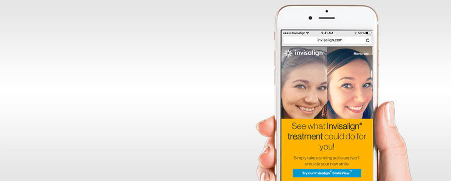 Invisalign SmileView Invisalign SmileView